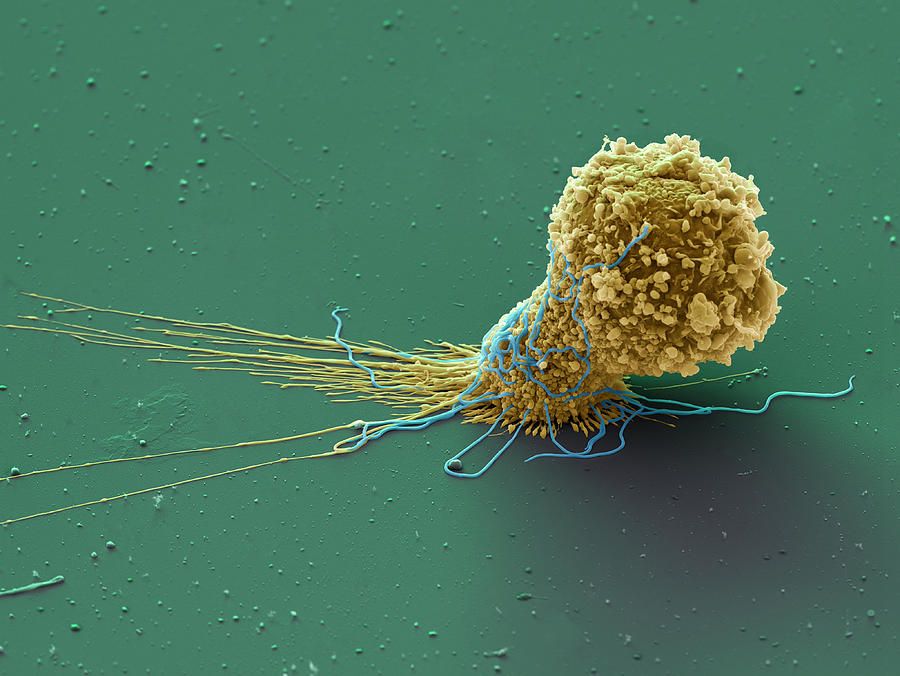 Macrophage With Borrelia Bacteria Sem Photograph by Meckes/ottawa