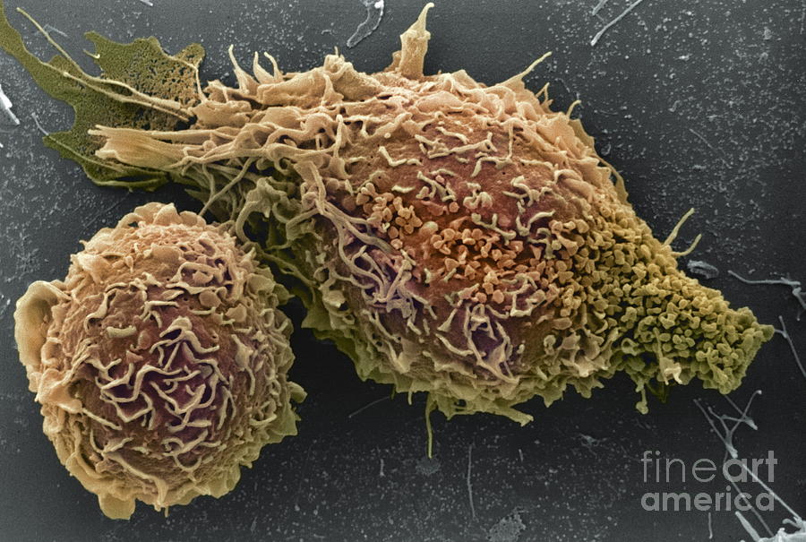 Macrophages Photograph by A. Dowsett, National Infection Service/science Photo  Library