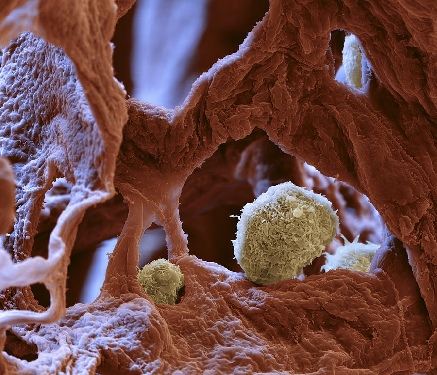 Macrophages In Pulmonary Alveolus, Sem Photograph by Meckes/ottawa