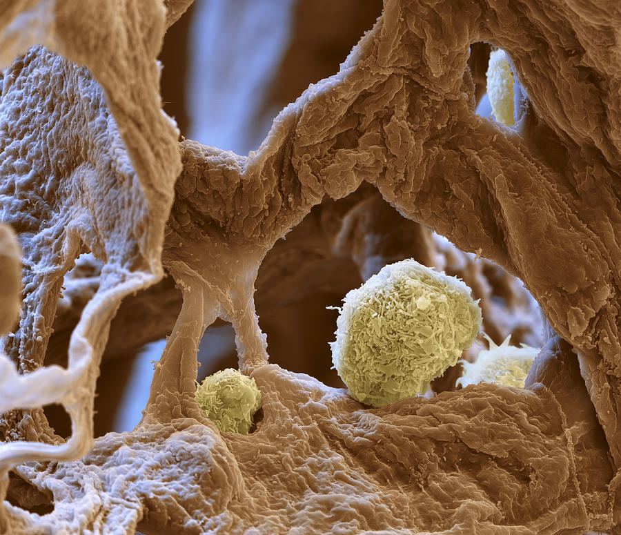 Macrophages In Pulmonary Alveolus, Sem Photograph by Oliver Meckes EYE OF SCIENCE