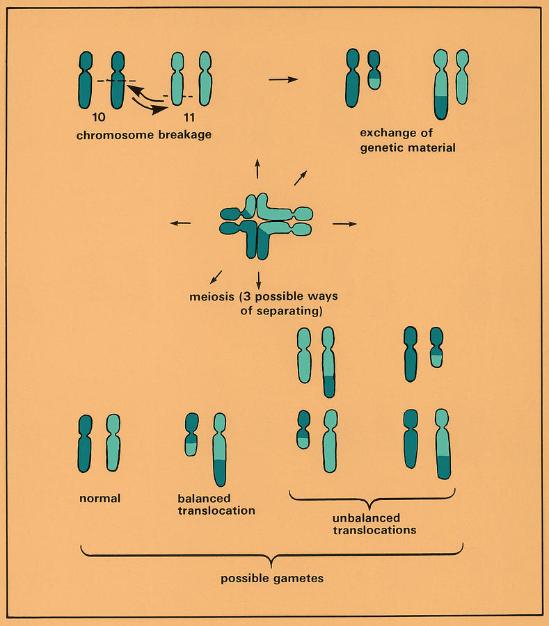 Chromosome Photograph - Male Balanced Translocation by Science Source
