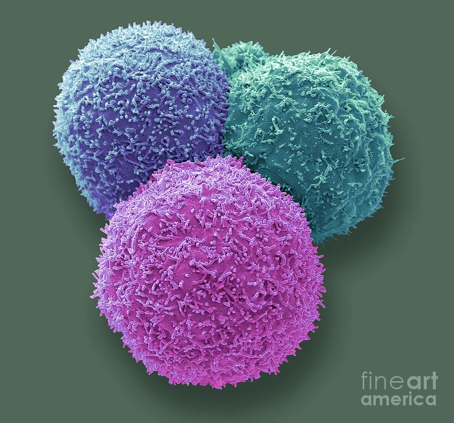 Mammalian Cells Photograph by Steve Gschmeissner/science Photo Library ...