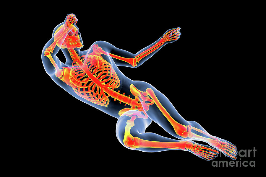 Man In Pain Photograph by Science Photo Library Man In Pain Photograph by Science Photo Library