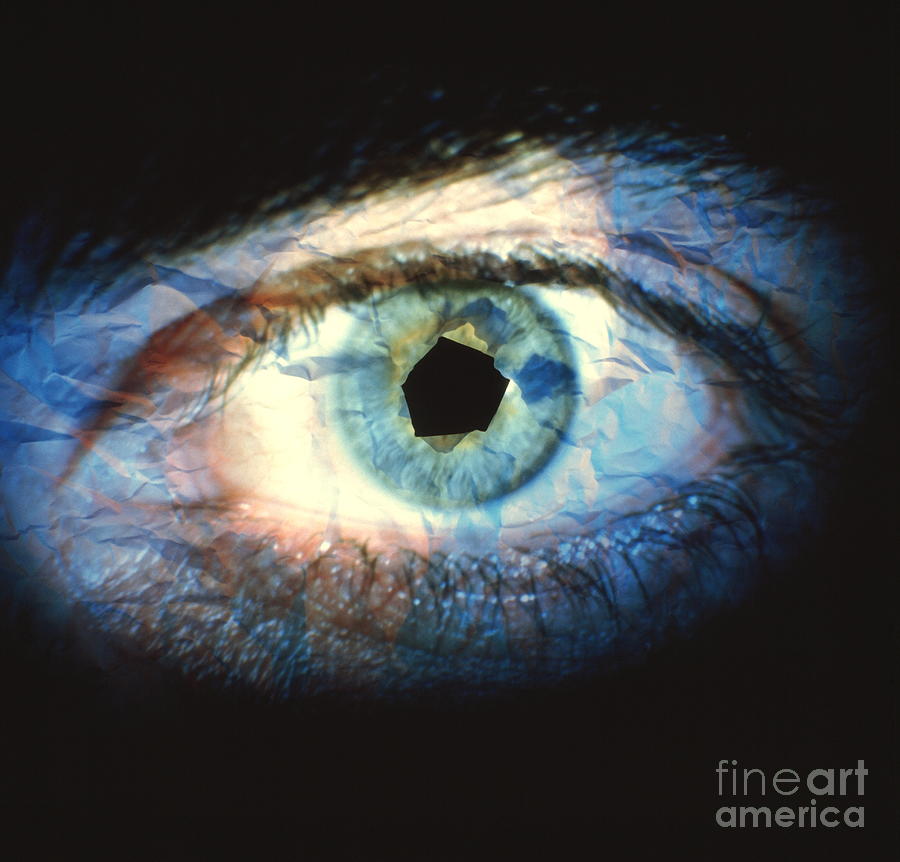 Mans Eye Photograph by Oscar Burriel/science Photo Library