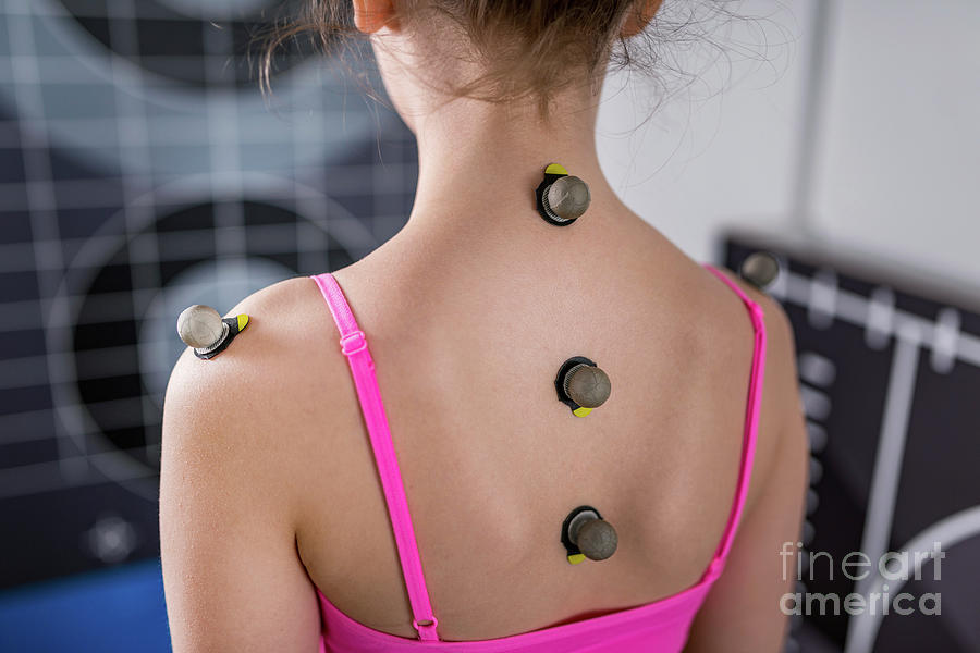 Markers For Posture Analysis Photograph by Microgen Images/science Photo Library