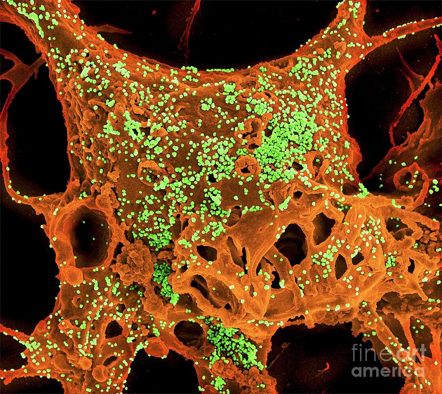 Biological Photograph - Mers Coronavirus Infection by National Institute Of Allergy And Infectious Diseases, National Institutes Of Health/science Photo Library