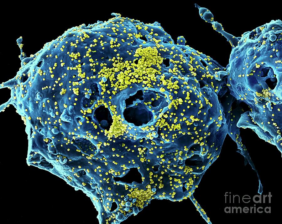 Mers Virus Particles Photograph by Niaid/science Photo Library - Fine ...