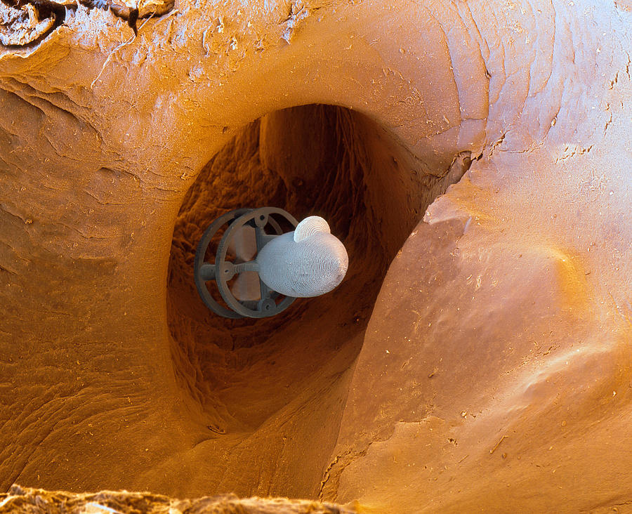 Micro-submarine In An Artery Photograph by Meckes/ottawa