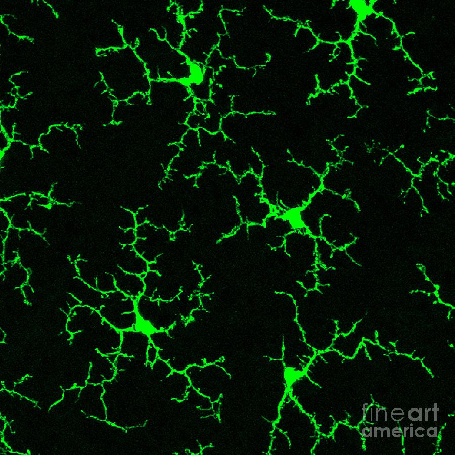 Microglia Retina Cells Photograph by Wai T. Wong, National Eye Institute, National Institutes Of Health/science Photo Library