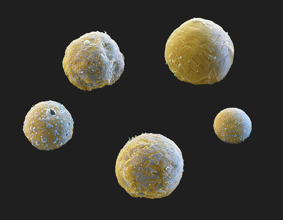 Milk Fat Droplets, Sem Photograph by Eye Of Science