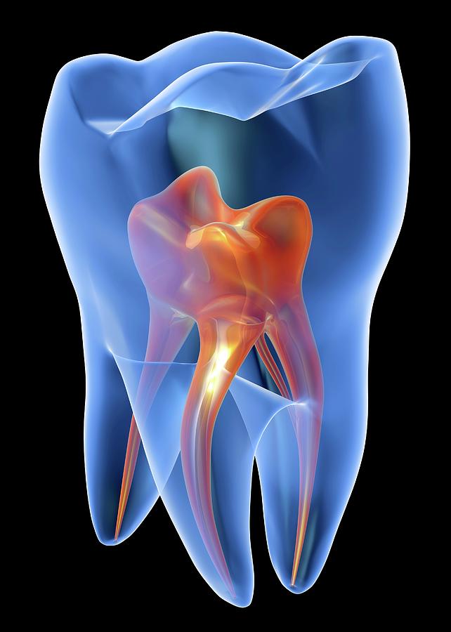Molar Tooth Digital Art by Science Photo Library - Pasieka