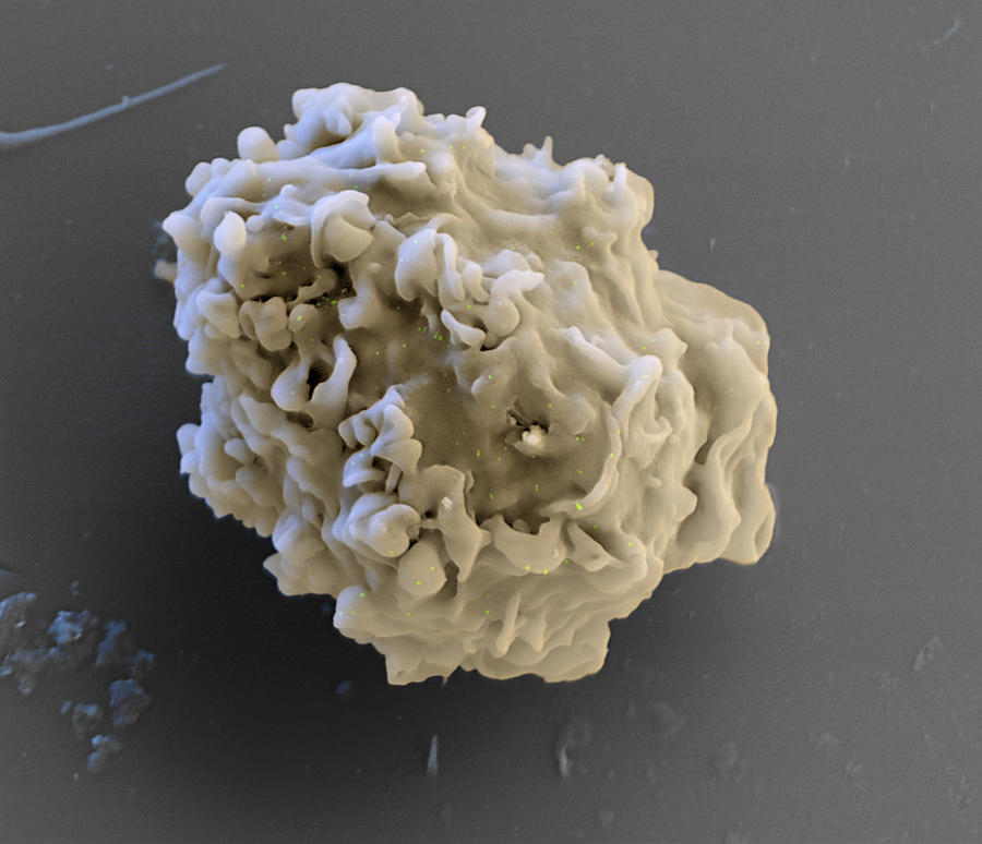 Monocyte White Blood Cell, Sem Photograph by Meckes/ottawa