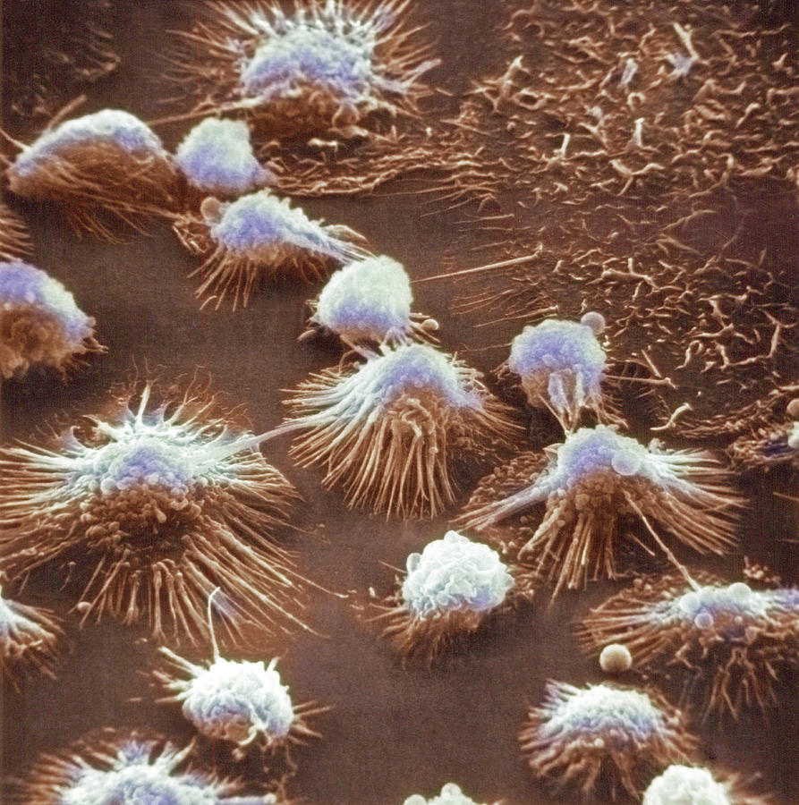 Monocytes, Sem Photograph by Biophoto Associates