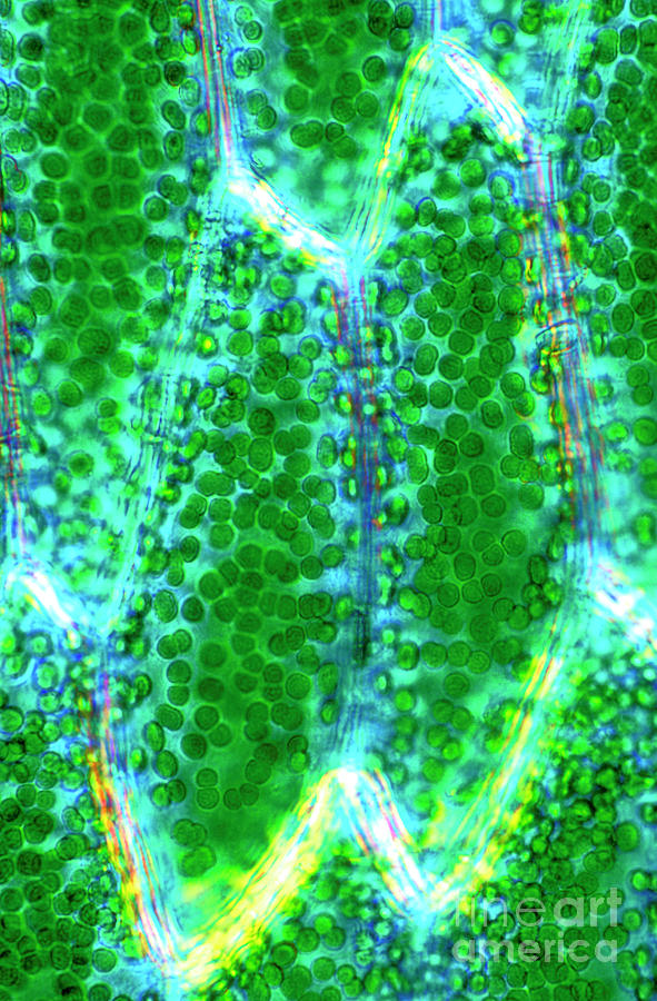 Moss Leaf Cells Photograph by Dr Keith Wheeler/science Photo Library