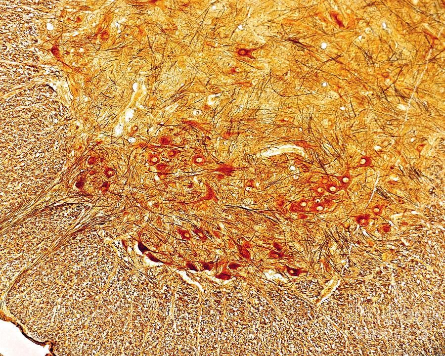 Cajal Photograph - Motor Neurons In Spinal Cord by Jose Calvo / Science Photo Library
