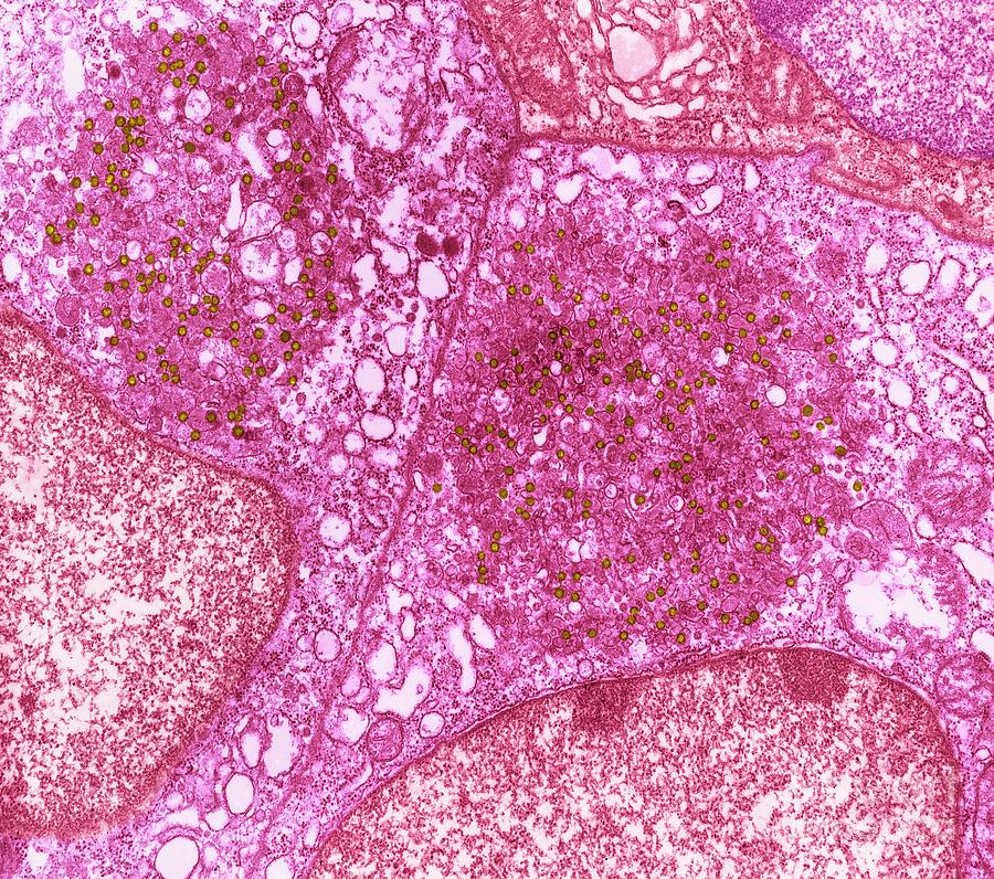 Mouse Mammary Tumour Virus Photograph by Steve Gschmeissner/science Photo Library