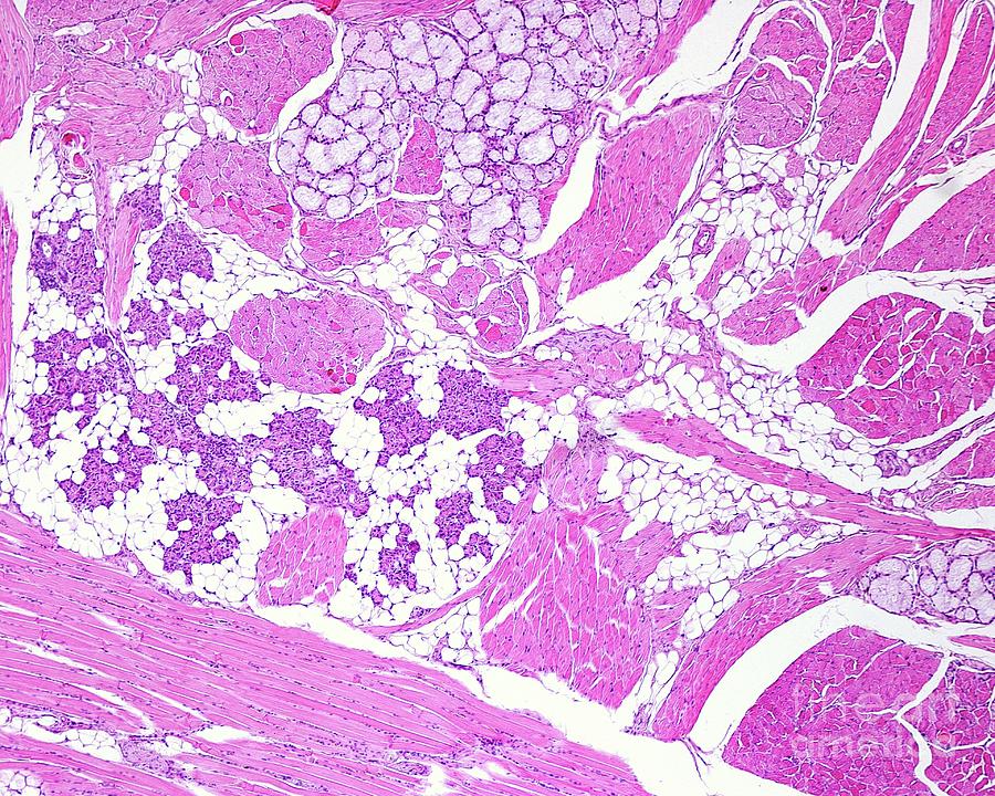 Mucous And Serous Glands by Jose Calvo/science Photo Library