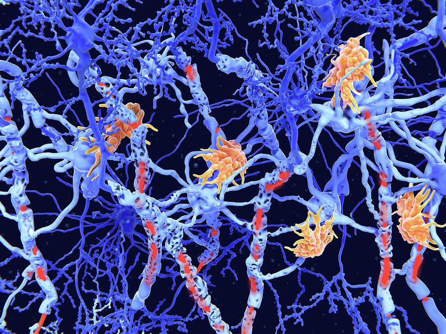Multiple Sclerosis Ms Microglia Cells Photograph by Juan Gaertner