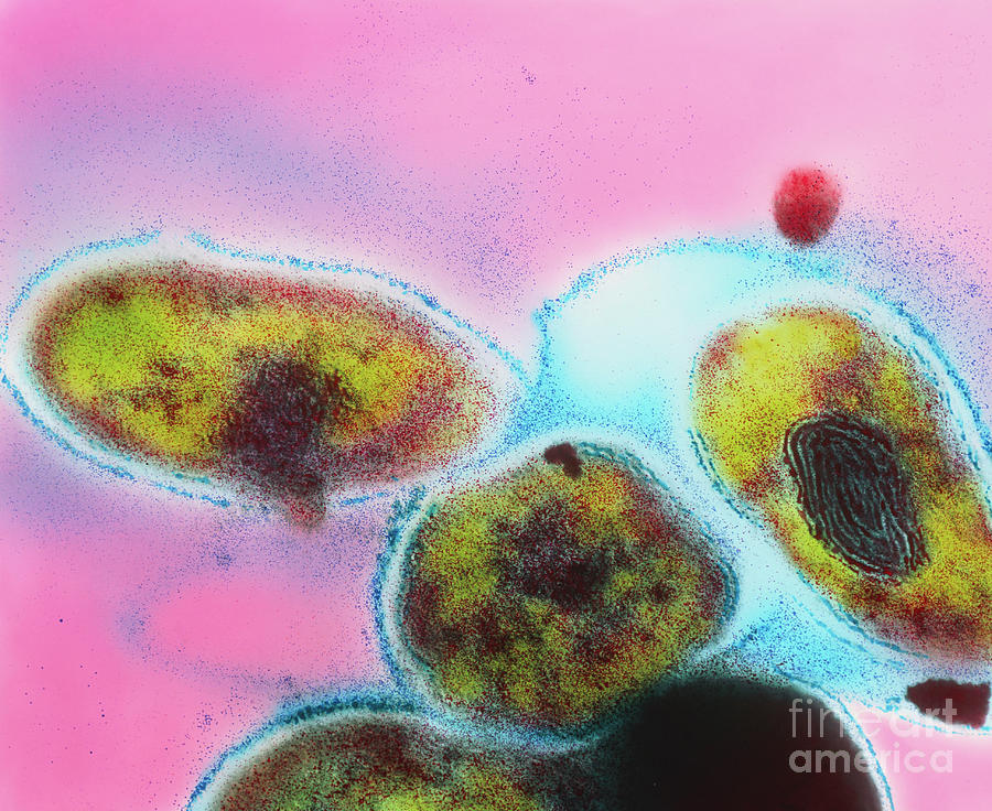 Mycobacterium Bacterial Complex Photograph By Dr Kari Lounatmaa Science