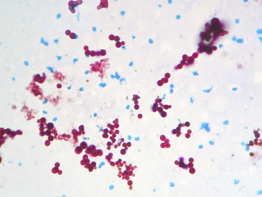 Mycobacterium Marinum Bacteria Photograph by Choksawatdikorn / Science ...