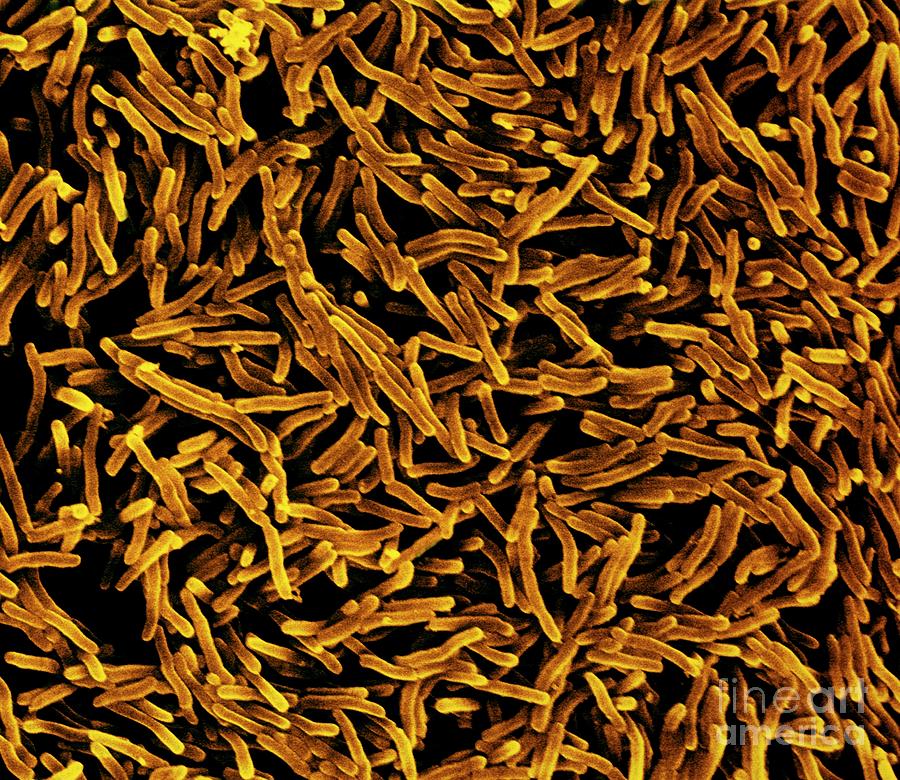 Mycobacterium Tuberculosis Bacteria Photograph By Steve Lowry Science Photo Library Fine Art