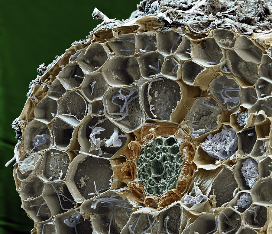 Mycorrhizal Fungi, Sem Photograph by Oliver Meckes EYE OF SCIENCE