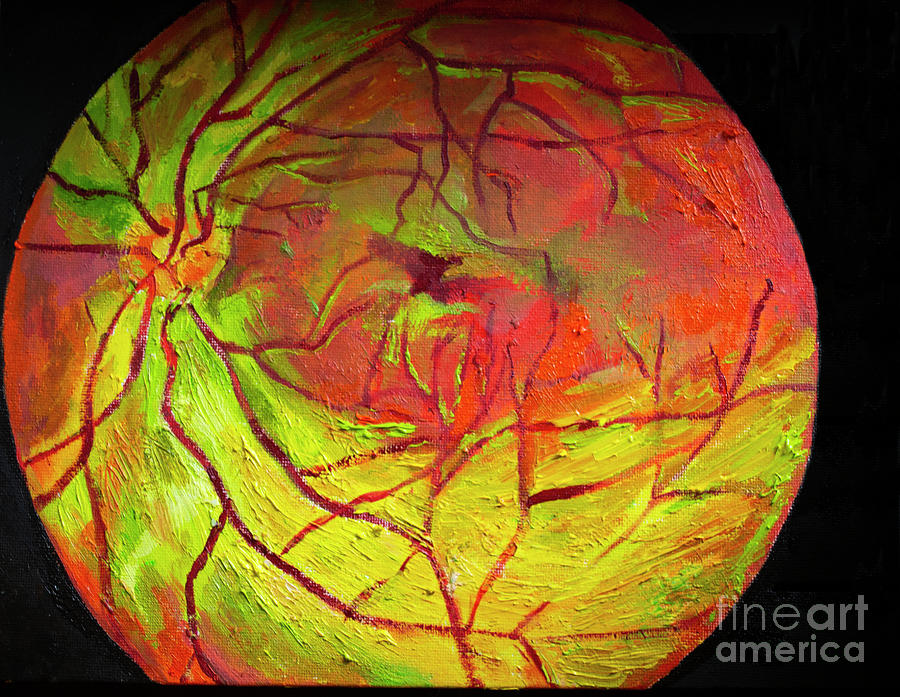 Science Painting - Myelinated Retinal Nerve Fiber Layer Optos  by Feyene Art