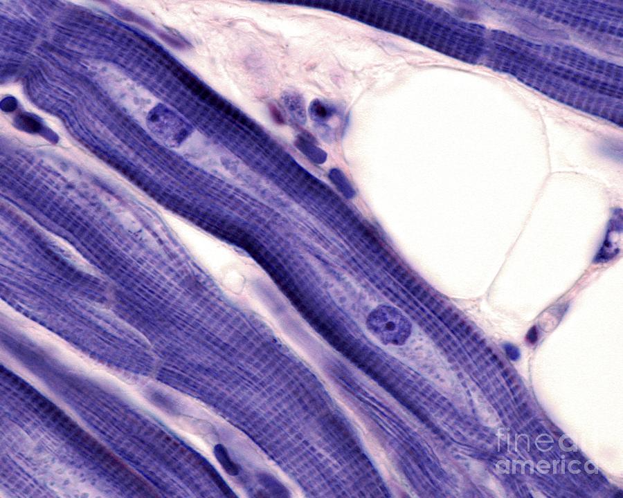 Myocardium Muscle Cells Photograph by Jose Calvo/science Photo Library
