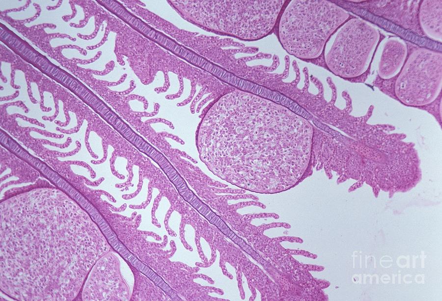 Myxosoma On Fish Gills. Lm Photograph by Carolina Biological Supply Company/science Photo Library
