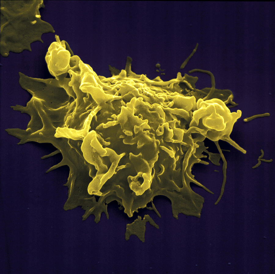 Natural Killer Cell Nk-cell Photograph by Meckes/ottawa