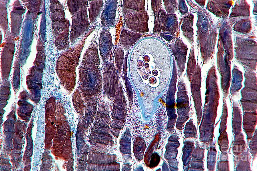 Nematode Larval Cyst Photograph by Dr Keith Wheeler/science Photo Library