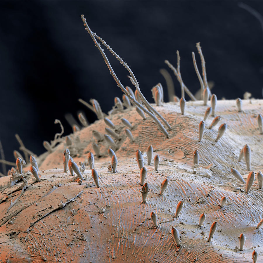 Net-winged Midge Larva Hairs, Sem Photograph by Eye Of Science