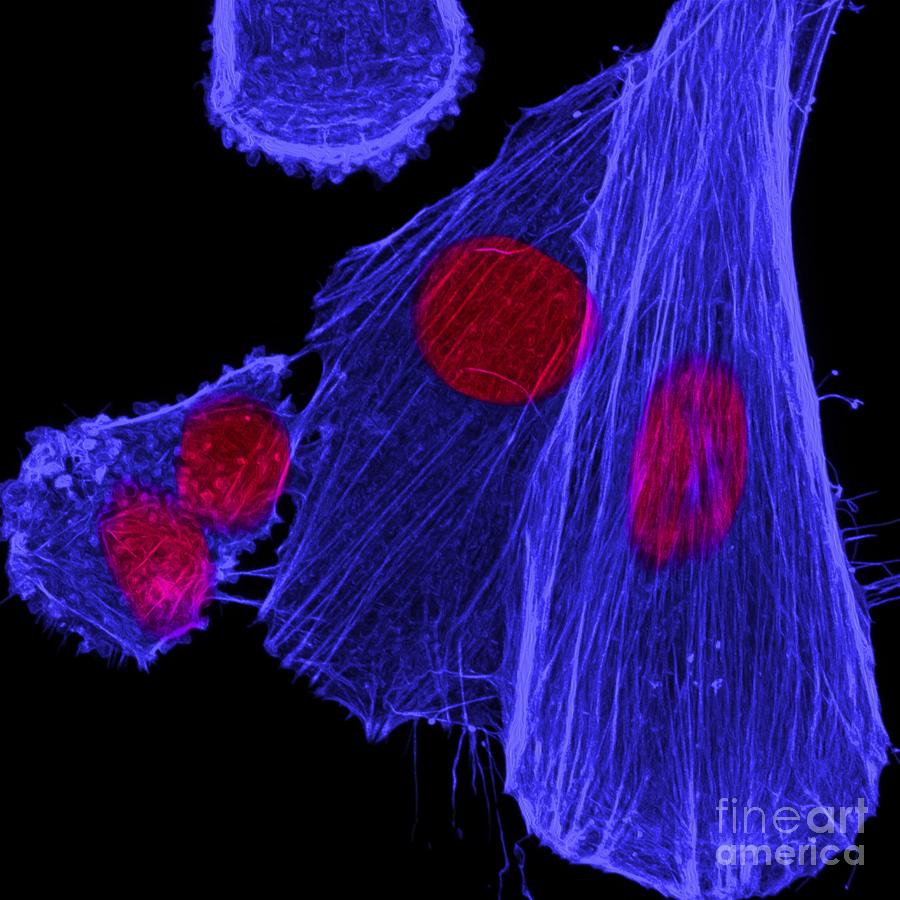 Neuroblastoma Nuclei And Cytoskeleton Photograph by Howard Vindin, The University Of Sydney/science Photo Library