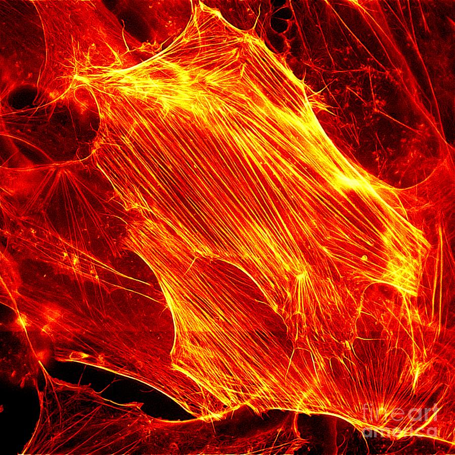 Neuroblastoma Showing Actin Filaments Photograph by Howard Vindin, The University Of Sydney/science Photo Library