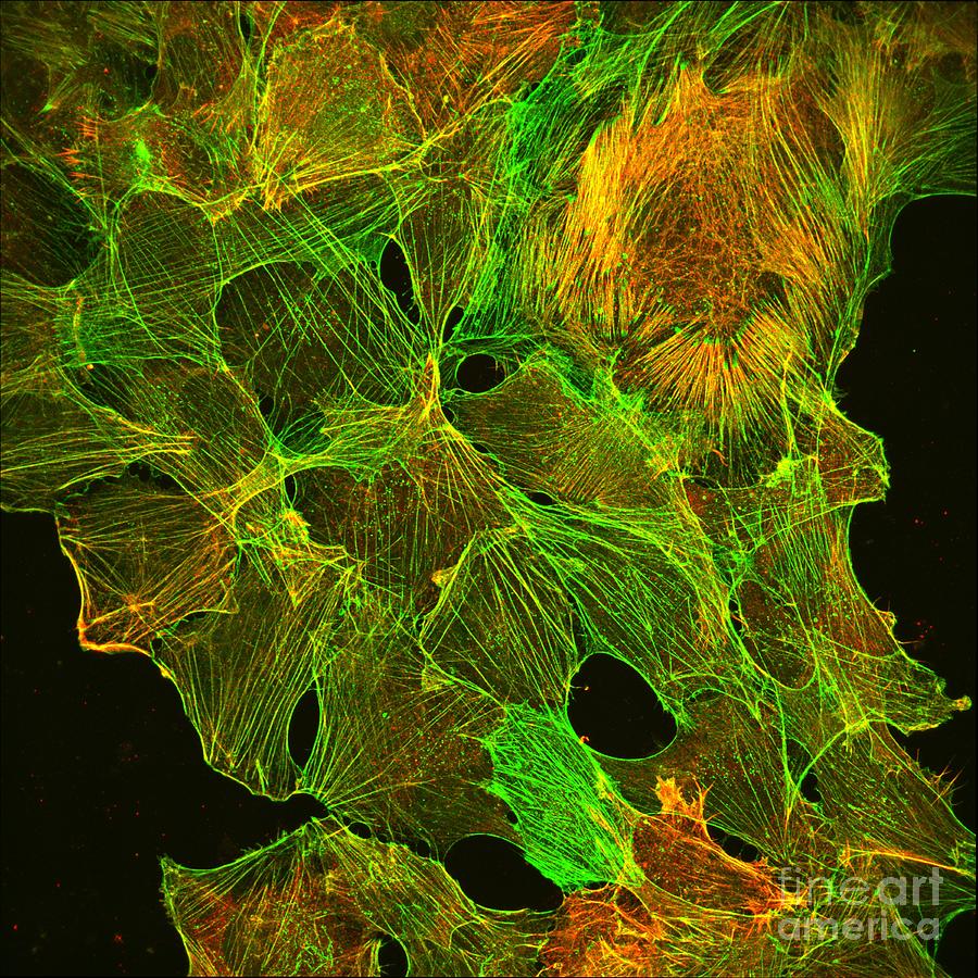 Neuroblastoma Showing Cytoskeleton Photograph by Howard Vindin, The University Of Sydney/science Photo Library