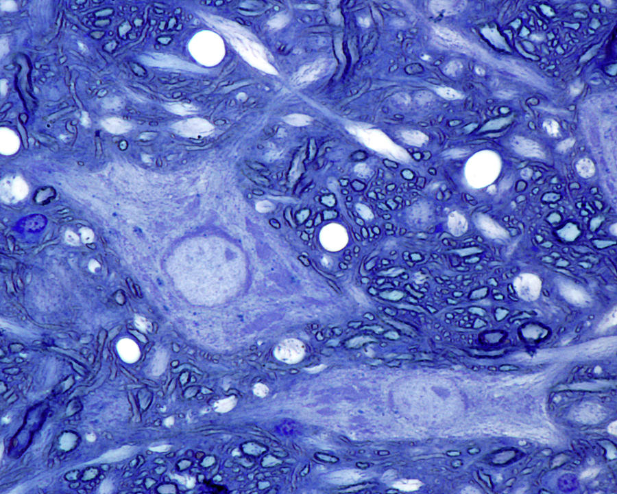 Neuron. Cell Body Photograph by Jose Luis Calvo
