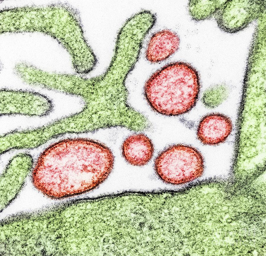 Nature Photograph - Nipah Virus by Niaid/science Photo Library