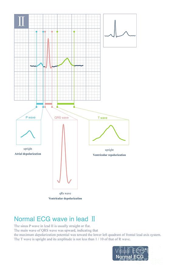 Normal Ecg Wave In Lead II Photograph by Chongqing Tumi Technology Ltd ...