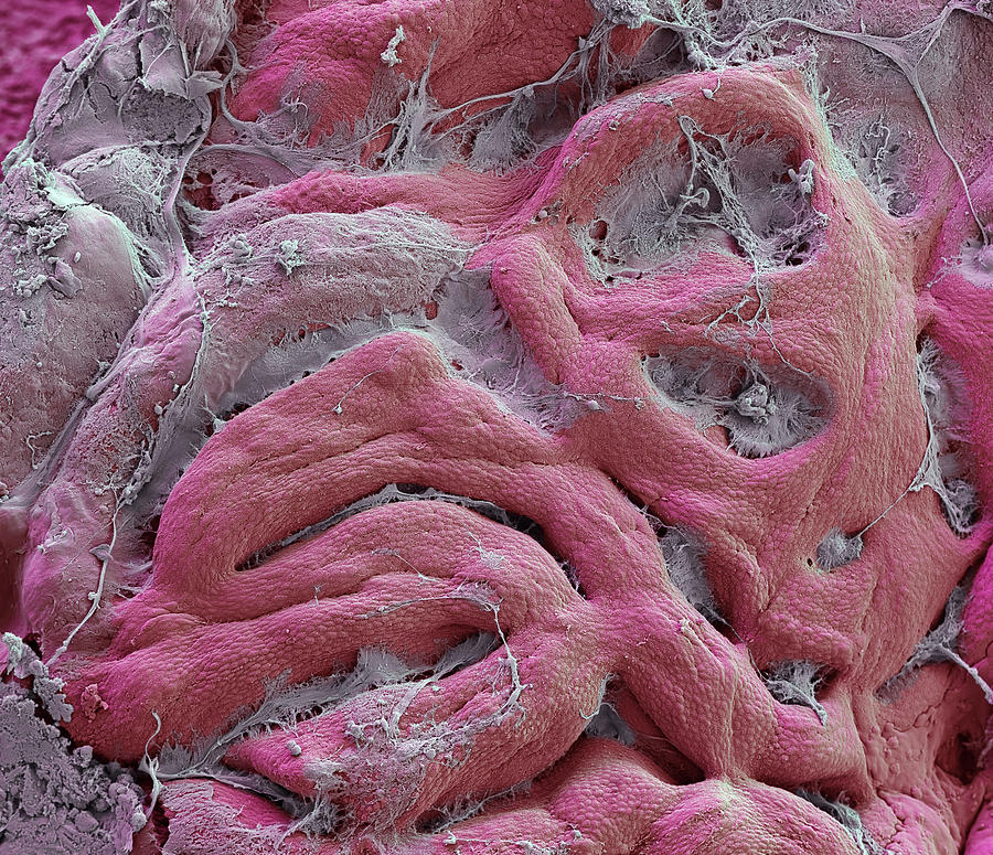 Normal Gastric Mucosa, Sem Photograph by Oliver Meckes - Fine Art America