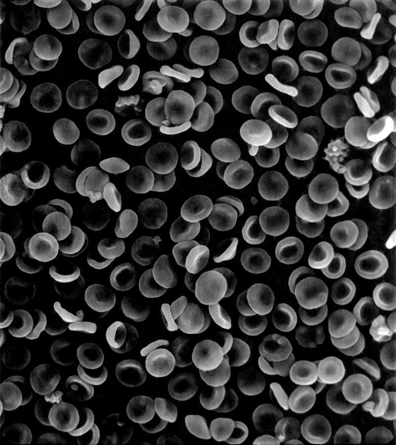 Normal Red Blood Cells, Sem Photograph by Stem Jems