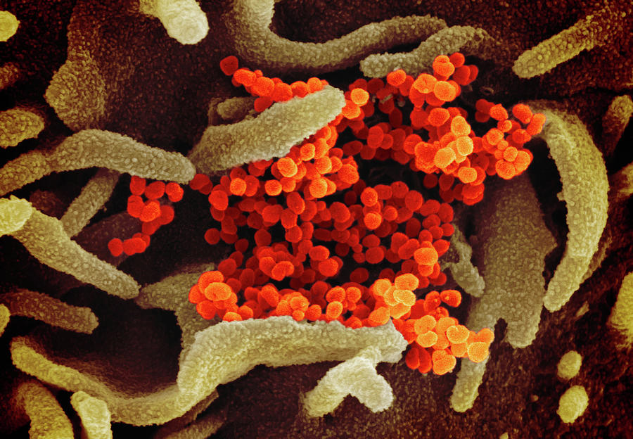 Novel Coronavirus Sars-cov-2 Photograph by Science Source