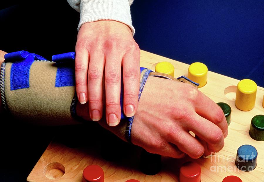 Occupational Therapy: Hands And Pegboard Photograph by John Greim/science Photo Library