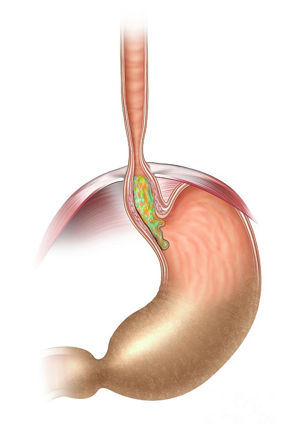 Oesophagus Photograph By Henning Dalhoff Science Photo Library Pixels