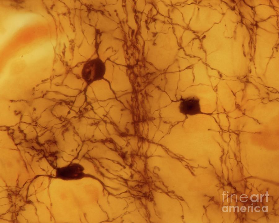 Oligodendroglia Photograph by Jose Calvo / Science Photo Library | Pixels