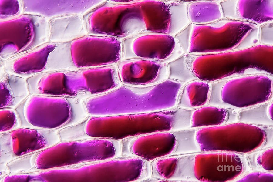 Onion Epidermis Plasmolysis Photograph by Gerd Guenther/science Photo Library