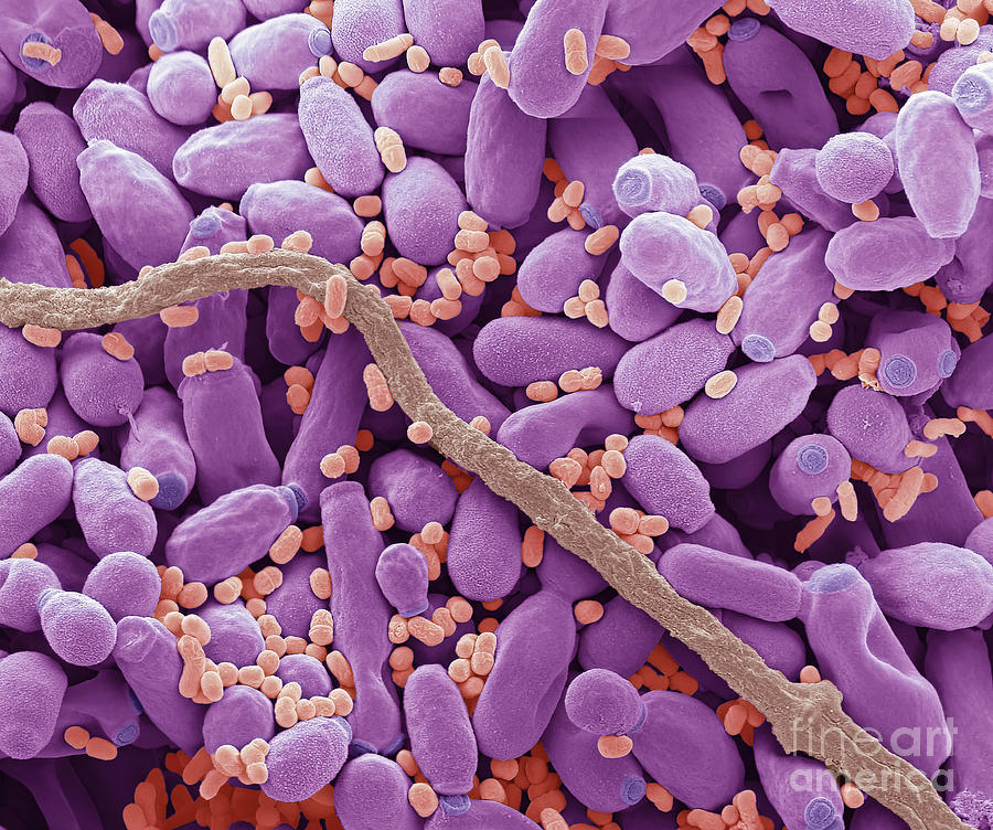 Oral Microbiota Photograph by Steve Gschmeissner/science Photo Library