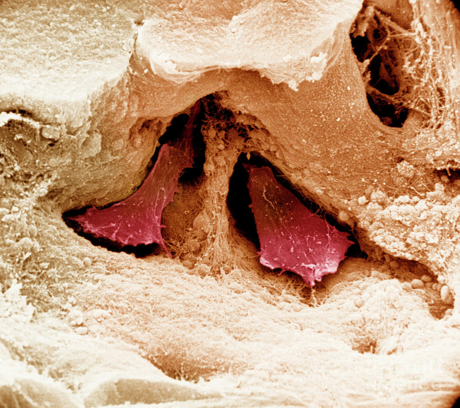 Osteoclasts Within Howship S Lacuna Sem Photograph By Dr Richard