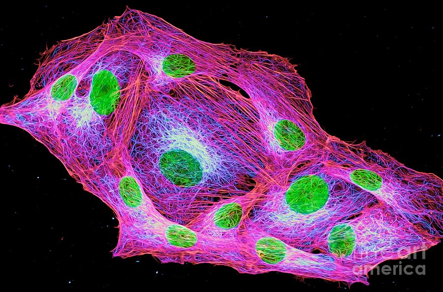 Osteosarcoma Cells Cytoskeleton And Nuclei Photograph by Howard Vindin, The University Of Sydney/science Photo Library