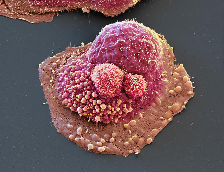 Ovarian Cancer Cell In Culture, Sem Photograph by Meckes/ottawa
