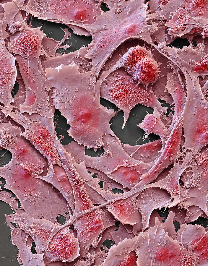 Ovarian Cancer Cells In Culture, Sem Photograph by Meckes/ottawa